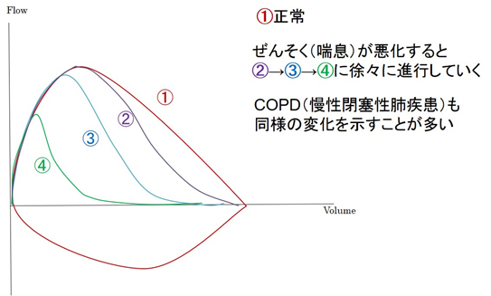 フローボリューム曲線