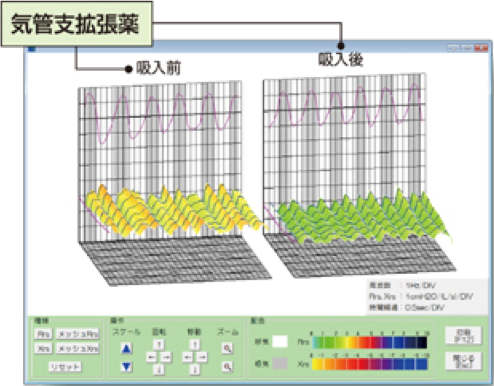 モストグラフ